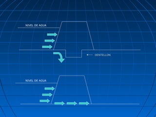 NIVEL DE AGUA




                DENTELLON




NIVEL DE AGUA
 