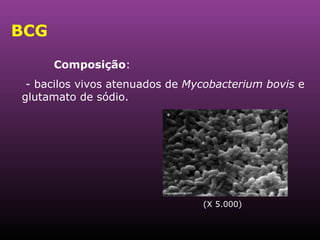 BCG Composição :  - bacilos vivos atenuados de  Mycobacterium bovis  e glutamato de sódio. (X 5.000) 