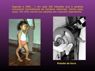 Segundo a OMS,  1 em cada 200 infecções leva à paralisia irreversível (normalmente de membros inferiores). Dentre estes casos, 5%-10% morrem por paralisia dos músculos respiratórios.  Pulmão de ferro 