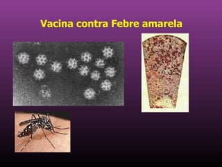 Vacina contra Febre amarela   