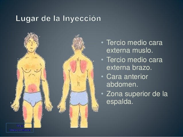 venopuncion