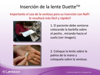 Importante el uso de la ventosa para su inserción con NaFl- le resultará más fácil y rápido!! 1. El paciente debe sentarse colocando la barbilla sobre el pecho , mirando hacia el suelo (ver imagen). 2. Coloque la lente sobre la palma de la mano y coloquela sobre la ventosa. Inserción de la lente Duette TM 