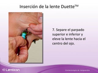 7. Separe el parpado superior e inferior y eleve la lente hacia el centro del ojo. Inserción de la lente Duette TM 