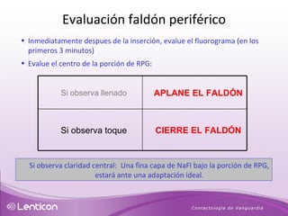 Si observa claridad central:  Una fina capa de NaFl bajo la porción de RPG, estará ante una adaptación ideal. Inmediatamente despues de la inserción, evalue el fluorograma (en los primeros 3 minutos) Evalue el centro de la porción de RPG: Evaluación faldón periférico Si observa llenado APLANE EL FALDÓN Si observa toque CIERRE EL FALDÓN 