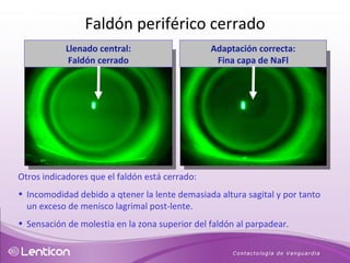Otros indicadores que el faldón está cerrado: Incomodidad debido a qtener la lente demasiada altura sagital y por tanto un exceso de menisco lagrimal post-lente. Sensación de molestia en la zona superior del faldón al parpadear. Faldón periférico cerrado Llenado central: Faldón cerrado Adaptación correcta: Fina capa de NaFl 
