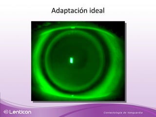 Adaptación ideal 