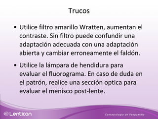Utilice filtro amarillo Wratten, aumentan el contraste. Sin filtro puede confundir una adaptación adecuada con una adaptación abierta y cambiar erroneamente el faldón. Utilice la lámpara de hendidura para evaluar el fluorograma. En caso de duda en el patrón, realice una sección optica para evaluar el menisco post-lente. Trucos 