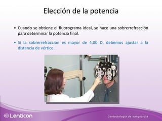 Cuando se obtiene el fluorograma ideal, se hace una sobrerrefracción para determinar la potencia final. Si la sobrerrefracción es mayor de 4,00 D, debemos ajustar a la distancia de vértice . Elección de la potencia 