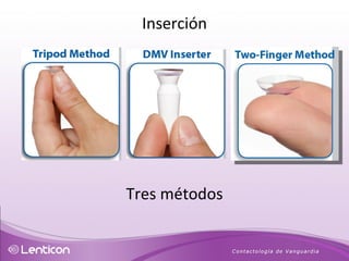 Inserción Tres métodos 