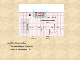 Seg Normal Definition Curso EKG | PPT