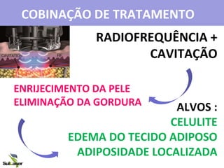 COBINAÇÃO DE TRATAMENTO
RADIOFREQUÊNCIA +
CAVITAÇÃO
ENRIJECIMENTO DA PELE
ELIMINAÇÃO DA GORDURA ALVOS :
CELULITE
EDEMA DO TECIDO ADIPOSO
ADIPOSIDADE LOCALIZADA
 