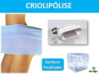 CRIOLIPÓLISE
Gordura
localizada
850KHz
From 300KHz to 1 MHz
up to 350 Watt
28 KHz
up to 100 Watt
- 20°
continuos/ pulsed
m rate 40 lt per minute
220 - 110 VAC ± 10%
, 60 Hz
740 x 560 x 1360 mm
THE BODY
CoaxMed Fusiome
CoaxMed, head of the famil
 
