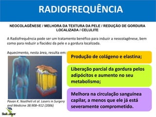 RADIOFREQUÊNCIA
NEOCOLAGÊNESE / MELHORA DA TEXTURA DA PELE / REDUÇÃO DE GORDURA
LOCALIZADA / CELULITE
A Radiofrequência pode ser um tratamento benéfico para induzir a neocolagênese, bem
como para reduzir a flacidez da pele e a gordura localizada.
Aquecimento, nesta área, resulta em:
Produção de colágeno e elastina;
Liberação parcial da gordura pelos
adipócitos e aumento no seu
metabolismo;
Melhora na circulação sanguínea
capilar, a menos que ele já está
severamente comprometido.
Pavan K. Nootheti et al. Lasers in Surgery
and Medicine 38:908–912 (2006)
 