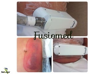 Curso Fusiomed - Apresentação.ppt