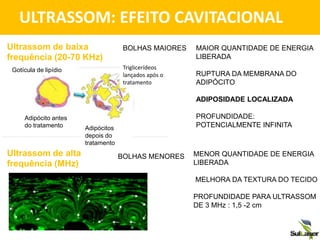 ULTRASSOM: EFEITO CAVITACIONAL
Ultrassom de baixa
frequência (20-70 KHz)
BOLHAS MAIORES
Ultrassom de alta
frequência (MHz)
BOLHAS MENORES
Gotícula de lipídio
Adipócito antes
do tratamento Adipócitos
depois do
tratamento
Triglicerídeos
lançados após o
tratamento
MAIOR QUANTIDADE DE ENERGIA
LIBERADA
RUPTURA DA MEMBRANA DO
ADIPÓCITO
ADIPOSIDADE LOCALIZADA
PROFUNDIDADE:
POTENCIALMENTE INFINITA
MENOR QUANTIDADE DE ENERGIA
LIBERADA
MELHORA DA TEXTURA DO TECIDO
PROFUNDIDADE PARA ULTRASSOM
DE 3 MHz : 1,5 -2 cm
 