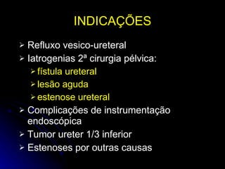 INDICAÇÕES Refluxo vesico-ureteral Iatrogenias 2ª cirurgia pélvica: fístula ureteral lesão aguda estenose ureteral Complicações de instrumentação endoscópica Tumor ureter 1/3 inferior Estenoses por outras causas 