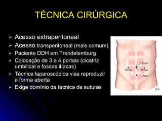 TÉCNICA CIRÚRGICA Acesso extraperitoneal Acesso  transperitoneal (mais comum) Paciente DDH em Trendelemburg Colocação de 3 a 4 portais (cicatriz umbilical e fossas ilíacas) Técnica laparoscópica visa reproduzir a forma aberta Exige domínio de técnica de suturas 
