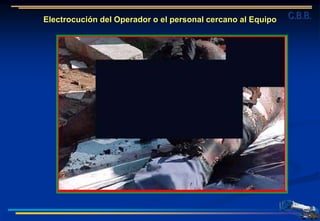 Electrocución del Operador o el personal cercano al Equipo C.B.B.
 