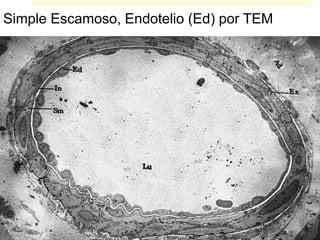 Simple Escamoso, Endotelio (Ed) por TEM
 