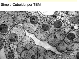 Simple Cuboidal por TEM
 