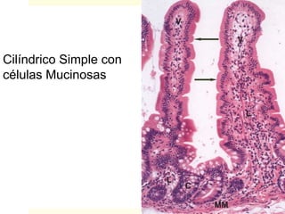 Cilíndrico Simple con
células Mucinosas
 