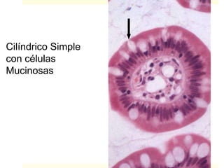 Cilíndrico Simple
con células
Mucinosas
 