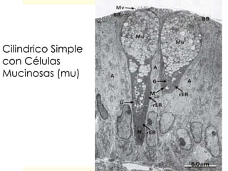 Cilindrico Simple
con Células
Mucinosas (mu)
 