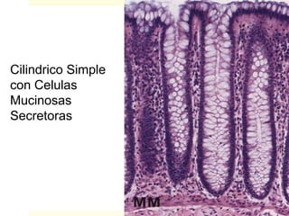 Cilindrico Simple
con Celulas
Mucinosas
Secretoras
 
