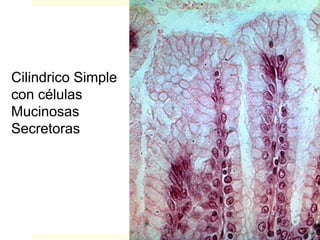 Cilindrico Simple
con células
Mucinosas
Secretoras
 