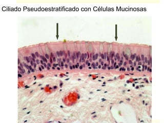 Ciliado Pseudoestratificado con Células Mucinosas
 