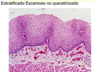 Estratificado Escamoso no queratinizado
 