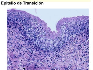 Epitelio de Transición
 