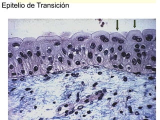 Epitelio de Transición
 