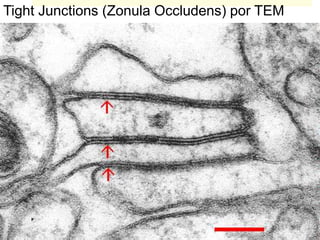 Tight Junctions (Zonula Occludens) por TEM
 
