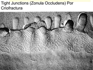 Tight Junctions (Zonula Occludens) Por
Criofractura
 