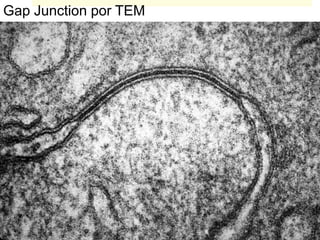 Gap Junction por TEM
 