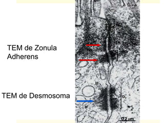 TEM de Zonula
Adherens
TEM de Desmosoma
 