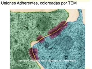 Uniones Adherentes, coloreadas por TEM
 