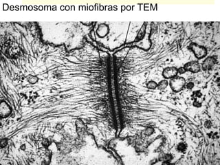 Desmosoma con miofibras por TEM
 