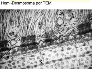 Hemi-Desmosoma por TEM
 