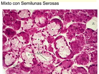 Mixto con Semilunas Serosas
 