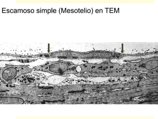 Escamoso simple (Mesotelio) en TEM
 