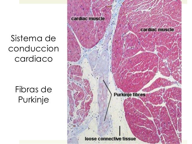 Resultado de imagen para fibras de purkinje