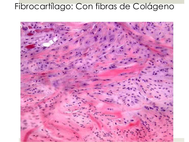 Resultado de imagen de fibrocartilago con fibras de colageno