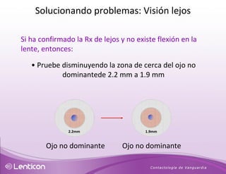 Si ha confirmado la Rx de lejos y no existe flexión en la lente, entonces: •   Pruebe disminuyendo la zona de cerca del ojo no dominantede 2.2 mm a 1.9 mm 2.2mm 1.9mm Ojo no dominante Ojo no dominante Solucionando problemas: Visión lejos 