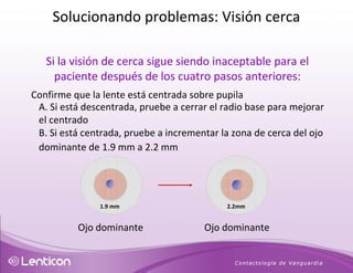 Si la visión de cerca sigue siendo inaceptable para el paciente después de los cuatro pasos anteriores: Confirme que la lente está centrada sobre pupila A. Si está descentrada, pruebe a cerrar el radio base para mejorar el centrado B. Si está centrada, pruebe a incrementar la zona de cerca del ojo dominante de 1.9 mm a 2.2 mm 1.9 mm 2.2mm Ojo dominante Ojo dominante Solucionando problemas: Visión cerca 