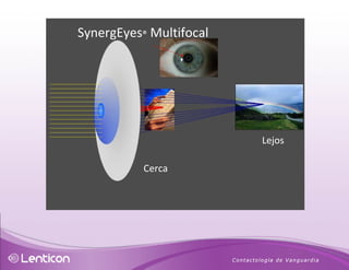 SynergEyes ®   Multifocal  Lejos Cerca 