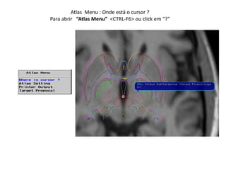 Atlas Menu : Onde está o cursor ?
Para abrir “Atlas Menu” <CTRL-F6> ou click em “?”
 