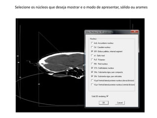 Selecione os núcleos que deseja mostrar e o modo de apresentar, sólido ou arames
 