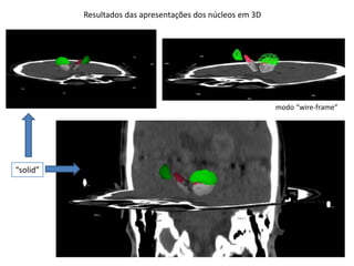Resultados das apresentações dos núcleos em 3D
modo “wire-frame”
“solid”
 